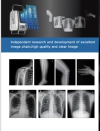 Yang Eva Portable X-Ray with inbuilt DR Systems - Portable
